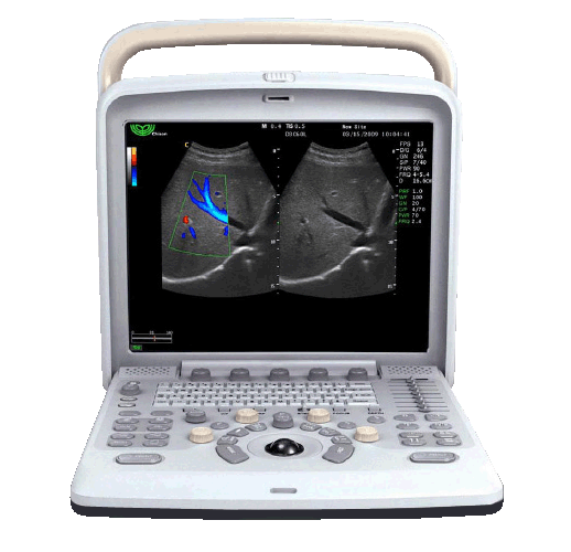 Chison Q6 portable color ultrasound