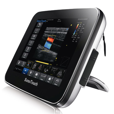 Chison SonoTouch 20 Tablet Ultrasound